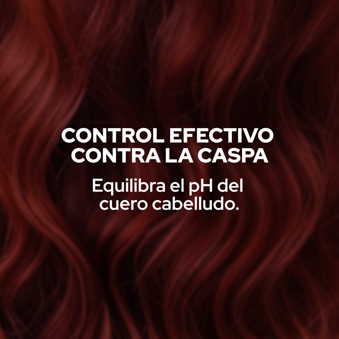 Shampoo Anticaspa Anyeluz X400 Ml - Image 3